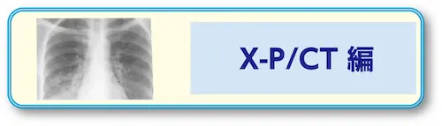 画像に alt 属性が指定されていません。ファイル名: opebth_3.png