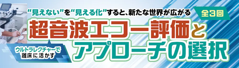 画像に alt 属性が指定されていません。ファイル名: HP_Echo_series7.webp