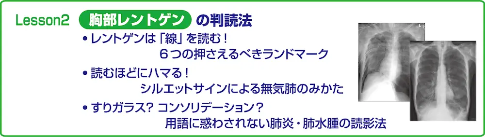 画像に alt 属性が指定されていません。ファイル名: trial_7-05.webp